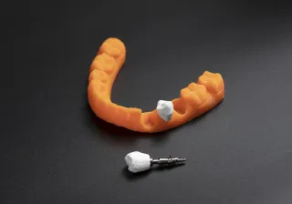 Nanocellulosebased dental implant crown created in VTT lab.