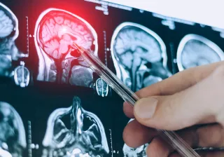 CT scan image of human brain. Mri or xray scan for diagnostic human head diseases.