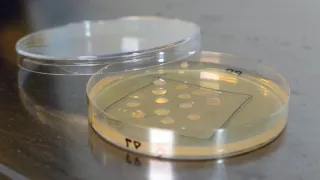 Photo of petri dish containing plasticdegrading microbes.