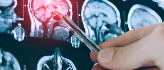 CT scan image of human brain. Mri or xray scan for diagnostic human head diseases.